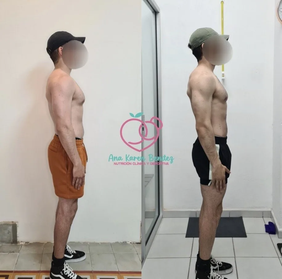 Caso de éxito: recomposición corporal en consulta de nutrición