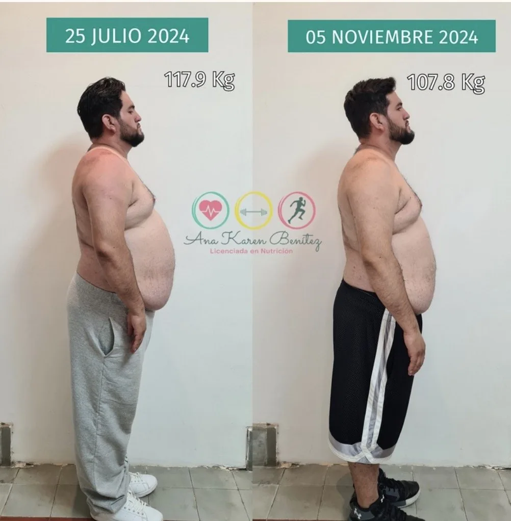 Caso de éxito: control de peso con nutrición clínica